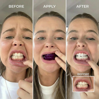 Osli Purple Teeth Whitening Strips