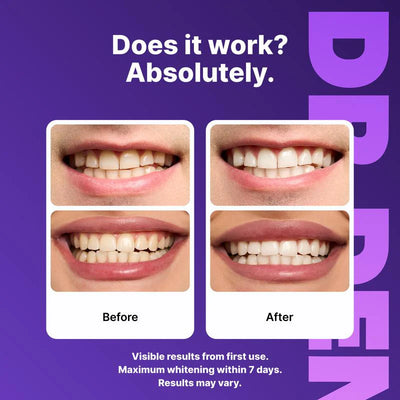 Osli Purple Teeth Whitening Strips