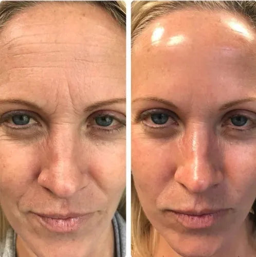 OSLI Milk Collagen Duo