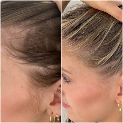 Hair Growth Accelerator Soft Chews