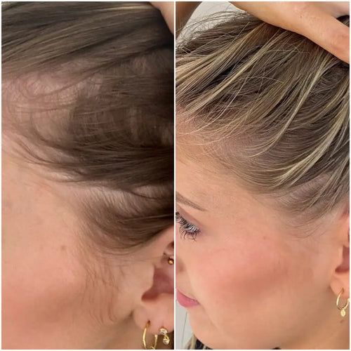 Hair Growth Accelerator Soft Chews