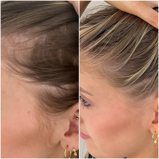 Hair Growth Accelerator Soft Chews