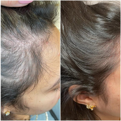 Hair Growth Accelerator Soft Chews