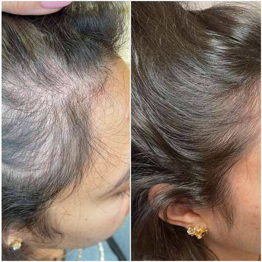 Hair Growth Accelerator Soft Chews