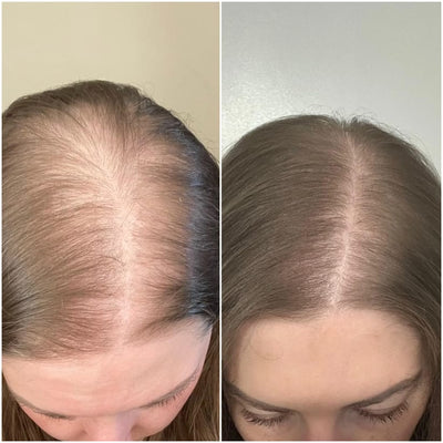 Hair Growth Accelerator Soft Chews