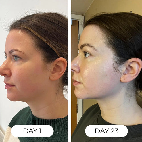 Organic Lymphatic Support Herbal Blend